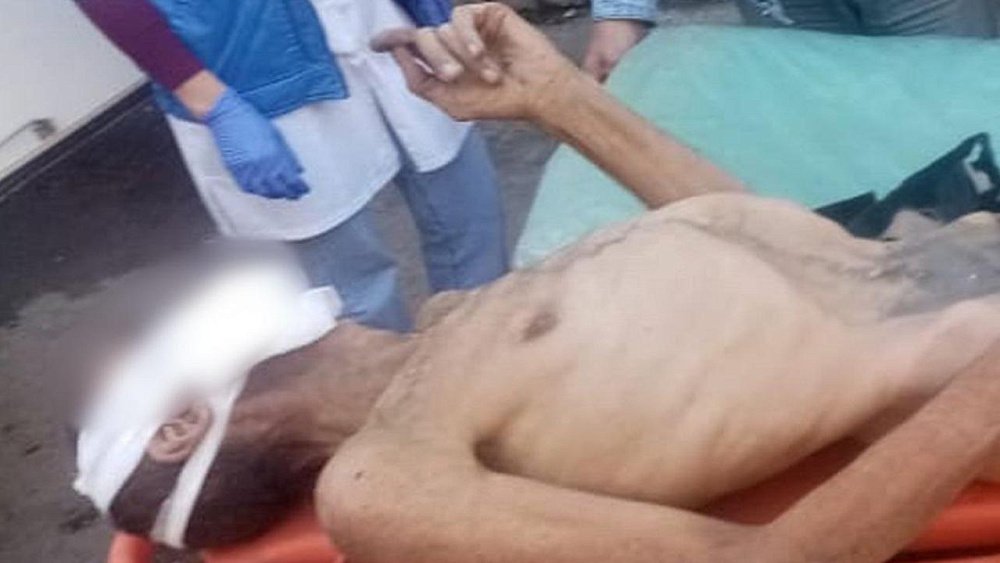 В подвале дома в Челябинской области нашли истощенного мужчину