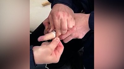 Спасатели помогли жителю Троицка снять кольцо с пальца