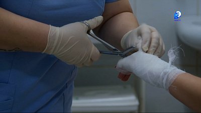 В Миассе из-за холодов участились случаи обморожения