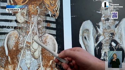 Урологи ЧОКБ провели уникальную операцию на почке