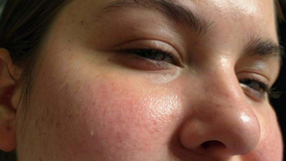 Может ли питье воды привести к отечности