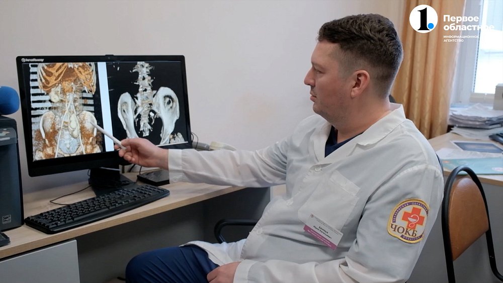 Урологи Челябинской областной больницы провели уникальную операцию на почке