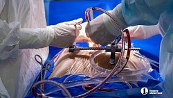 «Даже в больнице никогда не лежал»: 59‑летнему жителю Челябинской области пересадили чужое сердце