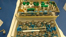 Челябинске врачи поставили на ноги пациента с тяжелой патологией