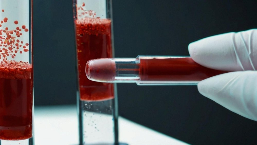 Лейкоцитоз является признаком этих болезней