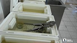 Челябинке, потерявшей в ДТП ногу, вернули возможность двигаться