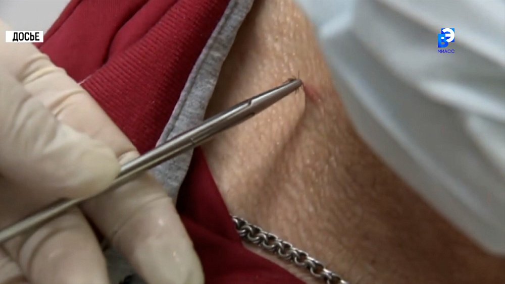 Более 1000 миасцев пострадали от укусов клещей