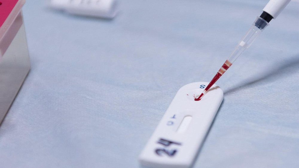 Когда тестирование на ВИЧ обязательно