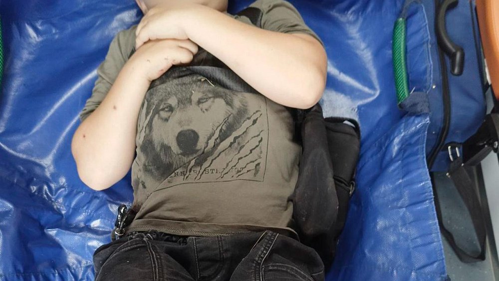 В Миассе мальчик упал с велосипеда и получил ранение живота