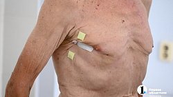 Двум пенсионерам из Челябинской области провели уникальные операции на сердце