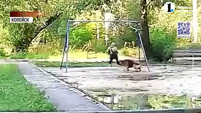 В Копейске собака укусила ребенка