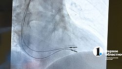 Челябинский кардиоцентр освоил подзарядку для сердца