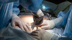 В Челябинске катетер для «домашнего» диализа впервые установили пациентке с экстремальным весом