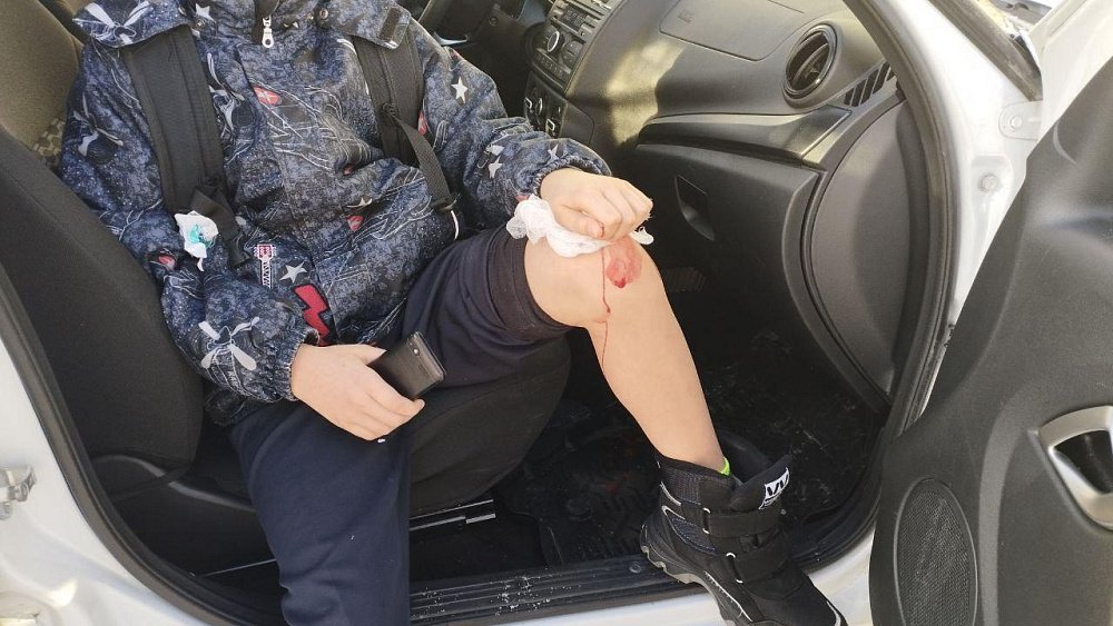 В Челябинске бездомные собаки до крови искусали школьника