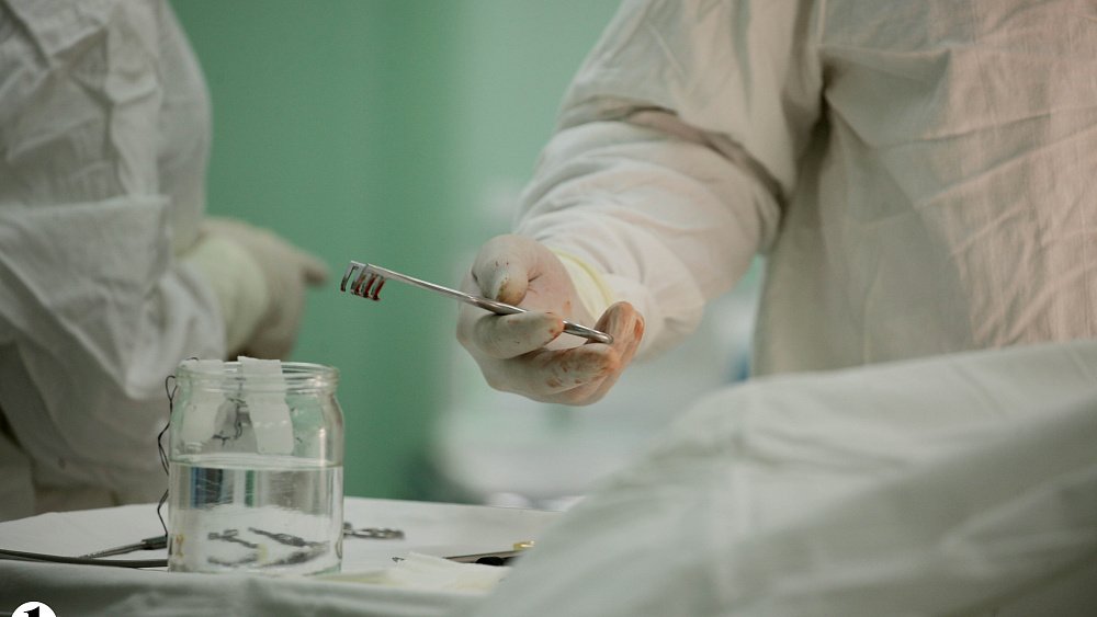 Челябинские хирурги удалили гигантский комок волос из желудка 14‑летней девочки