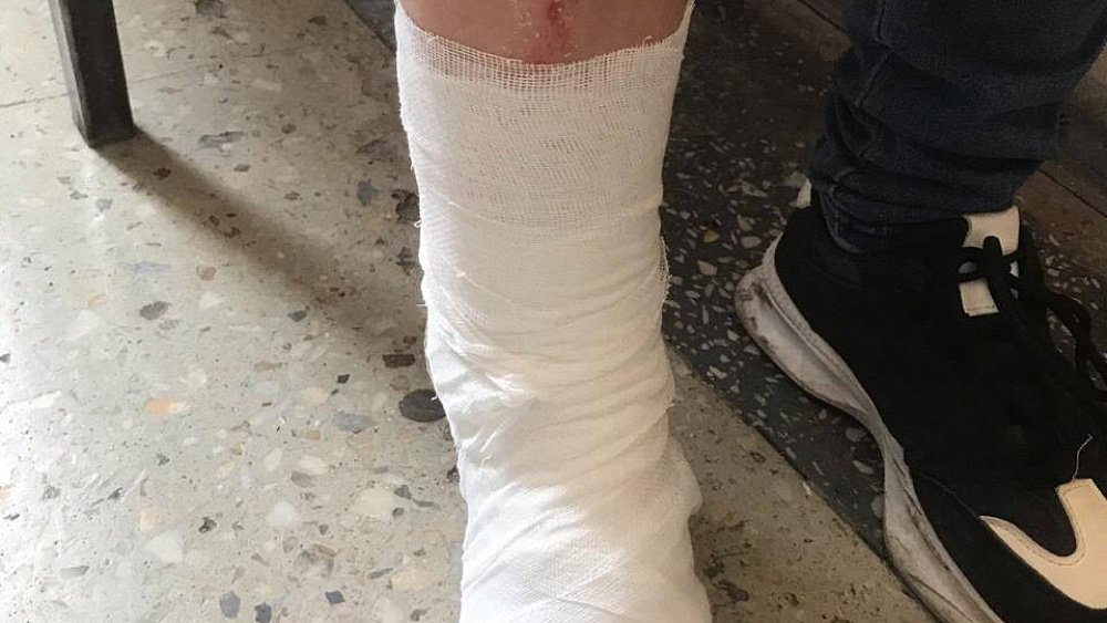 В Челябинской области на 12‑летнюю девочку упали футбольные ворота