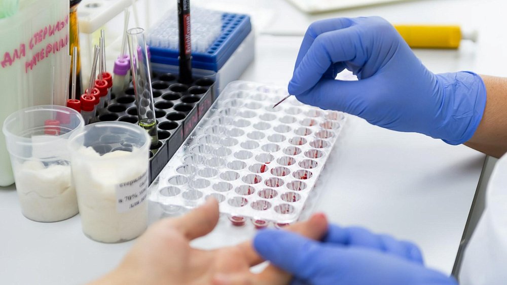 Риски тромбообразования может определить тест на D‑димер