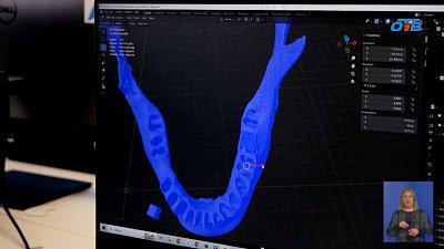 Юные программисты из Миасса разработали симулятор для медиков