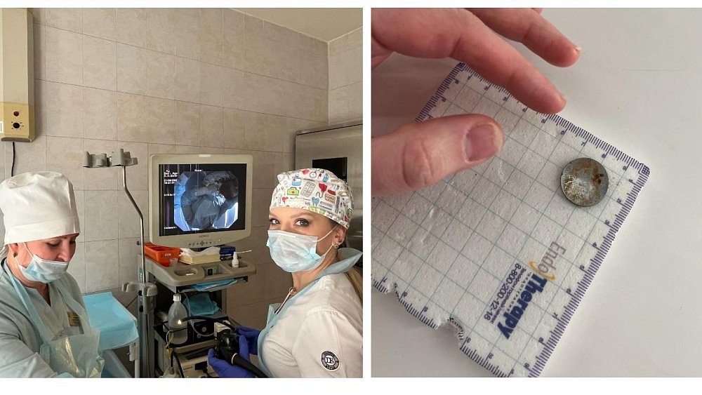 Челябинские медики спасли жизнь малышки, проглотившей батарейку