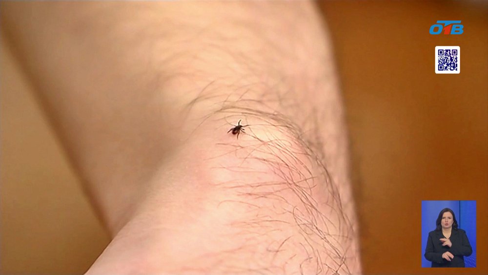 Клещи атакуют Магнитогорск