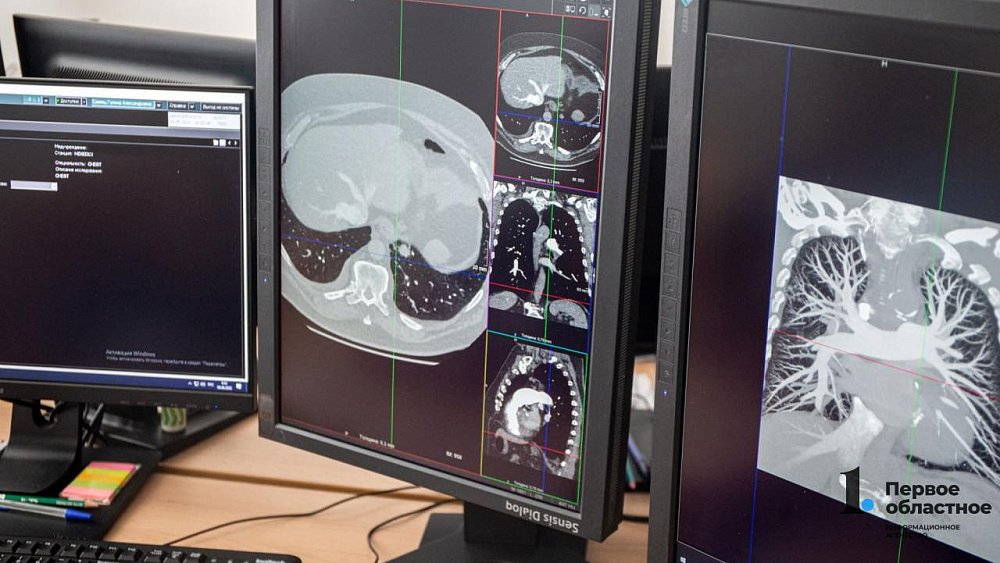 Централизованный архив медицинских изображений создают в Челябинской области