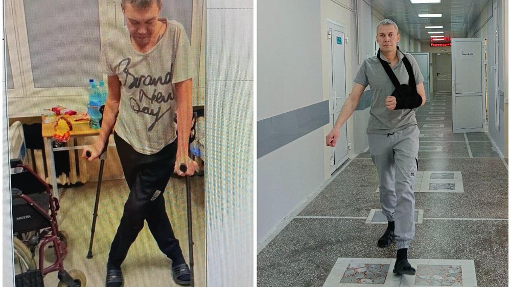 Челябинские врачи спасли мужчину, ноги которого скрутило буквой Х