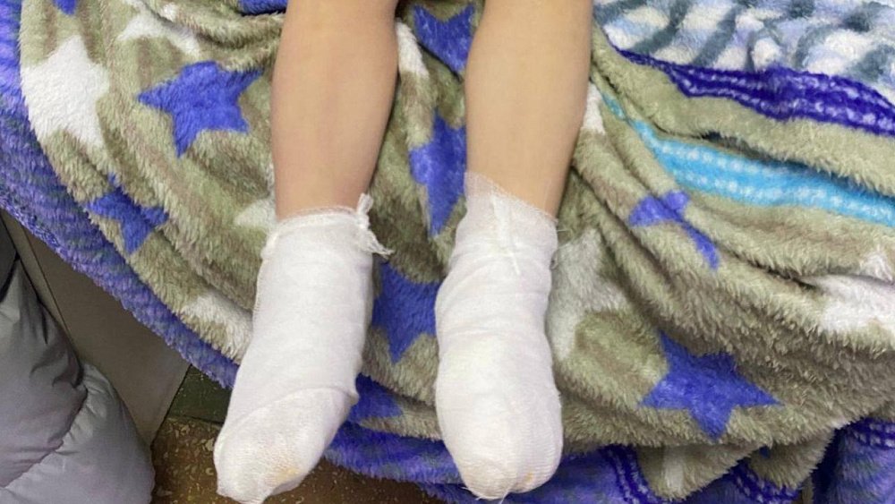 Трехлетнему мальчику обварило ноги кипятком в детсаду в Копейске