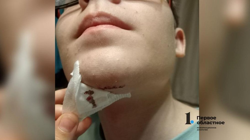 Школьник из Челябинска получил травму во время отдыха в термах