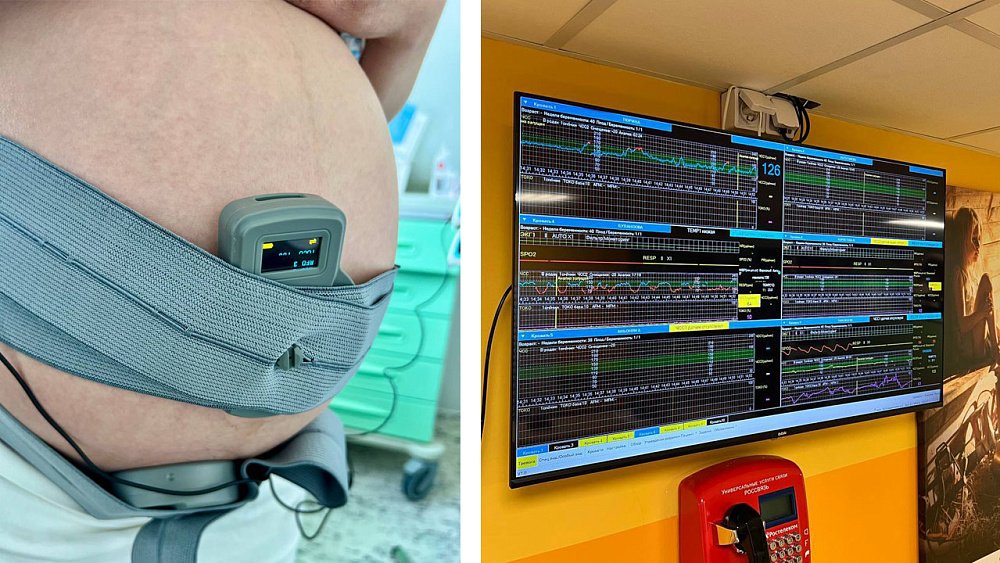 В челябинском ОПЦ с новым оборудованием стало проще сохранять беременность