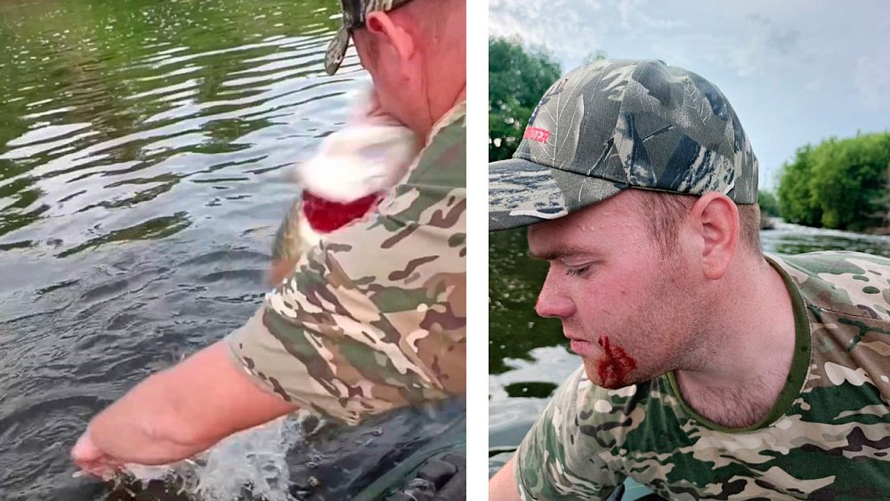 Щука укусила в лицо рыбака из Челябинской области