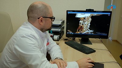 Челябинские хирурги избавили пациентку от гигантской аневризмы сонной артерии