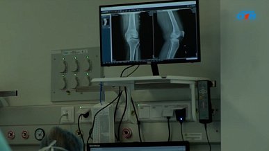 В Челябинске лечат асептический некроз тазобедренных суставов