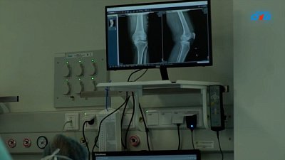 В Челябинске лечат асептический некроз тазобедренных суставов