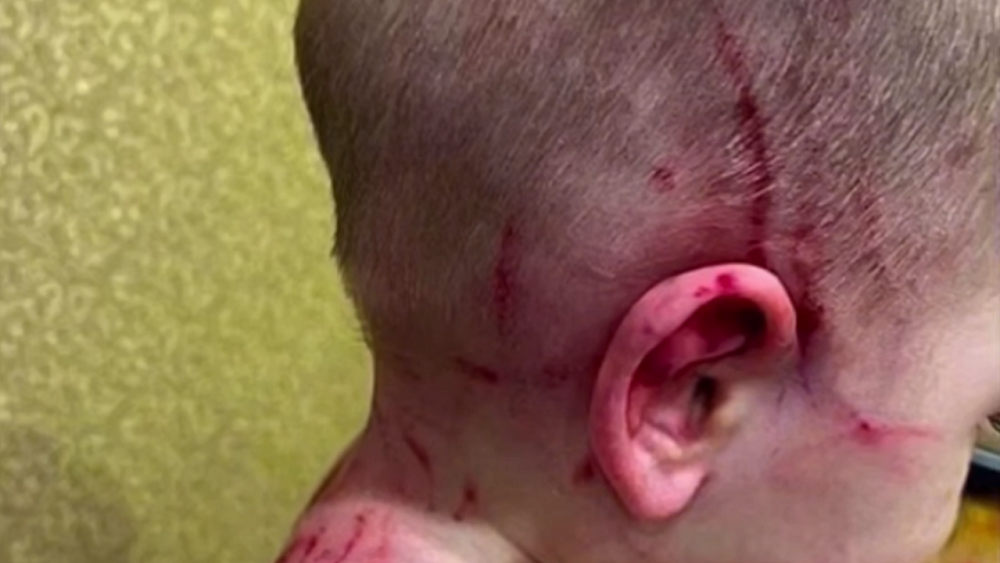 В Челябинске возбуждено дело после нападения стаффордширского терьера на двоих детей