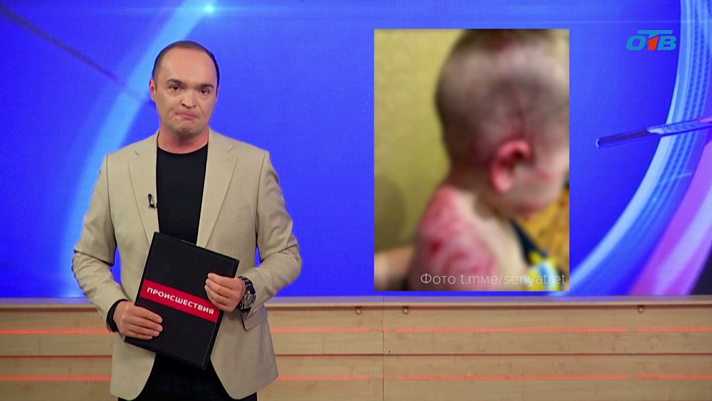 Бастрыкин потребовал доклад об инциденте с нападением собаки на детей в Челябинске