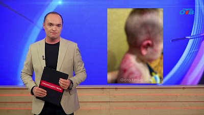 Бастрыкин потребовал доклад об инциденте с нападением собаки на детей в Челябинске