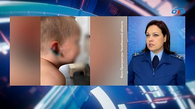 В Кременкуле собака отгрызла ухо малышу