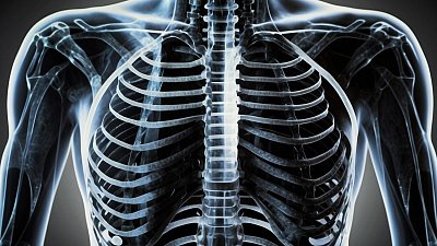 Какую дозу облучения человек получает на рентгене