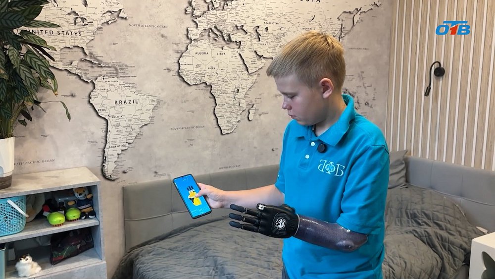 Мальчик из Миасса получил киберруку