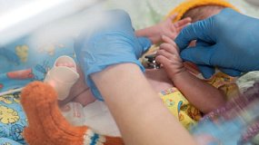 Международный день недоношенных детей отмечают 17 ноября