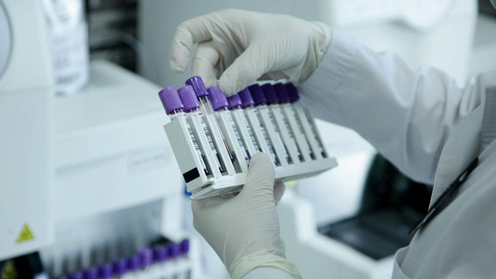 Почему анализ крови важно сдавать натощак