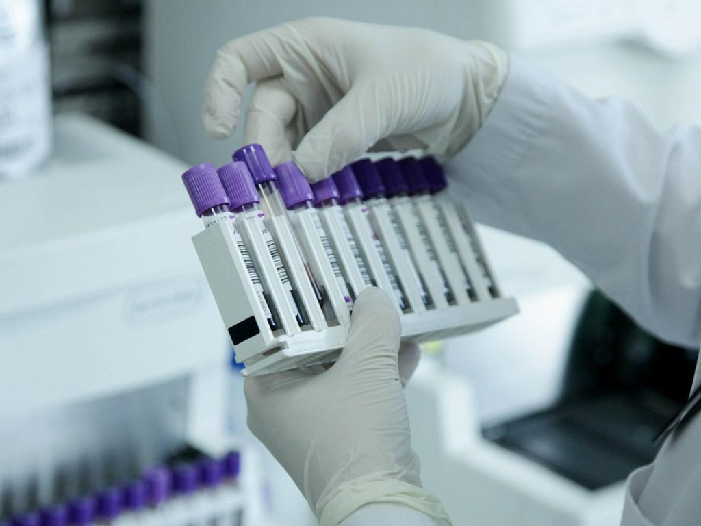 Почему анализ крови важно сдавать натощак