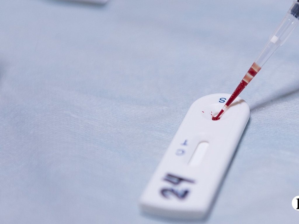 ВИЧ в Челябинской области стал чаще распространяться среди женщин 30 лет