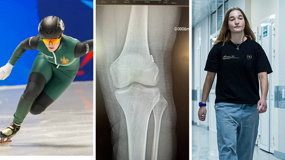 Челябинские врачи поставили на ноги конькобежку после сложнейшей операции на мениске