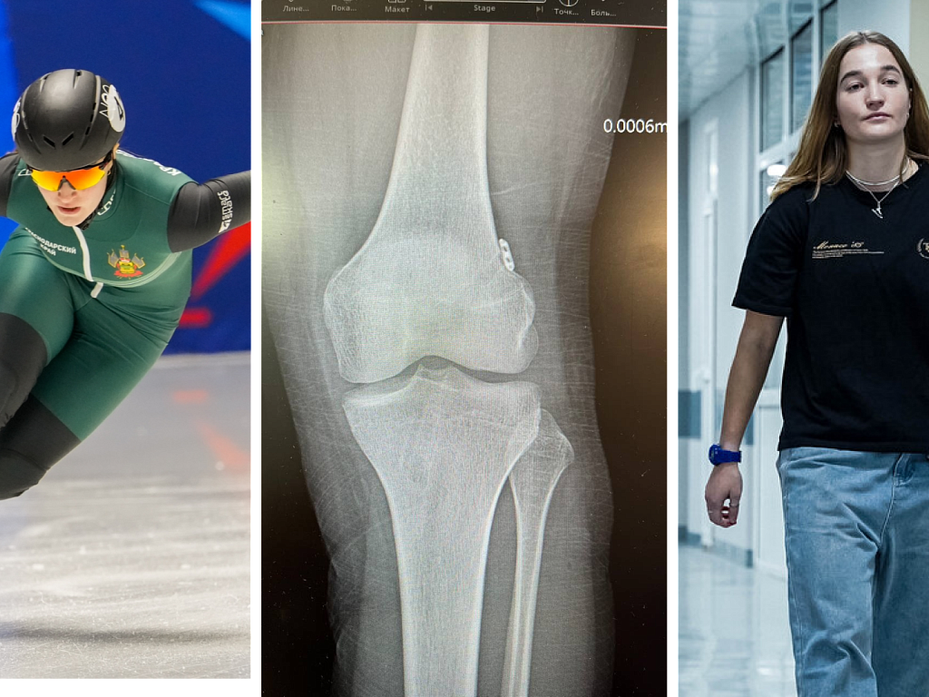 Челябинские врачи поставили на ноги конькобежку после сложнейшей операции на мениске