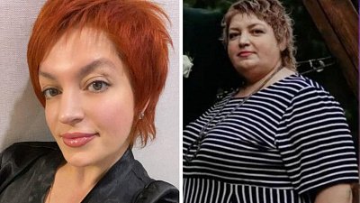 Челябинские врачи помогли жительнице Кыштыма похудеть на 70 килограммов