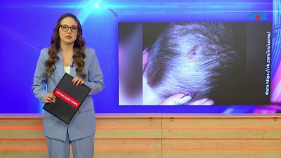 В Еманжелинске медика детского сада привлекли к дисциплинарному взысканию за травму ребенку