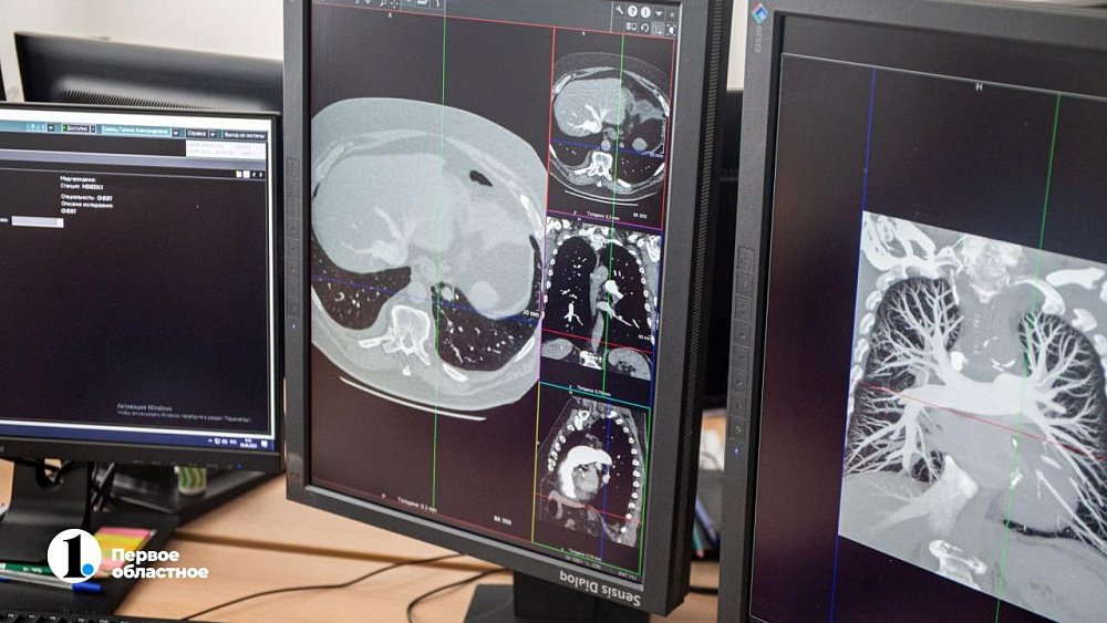 Каждый второй рентген-аппарат в Челябинской области подключен к единой цифровой базе