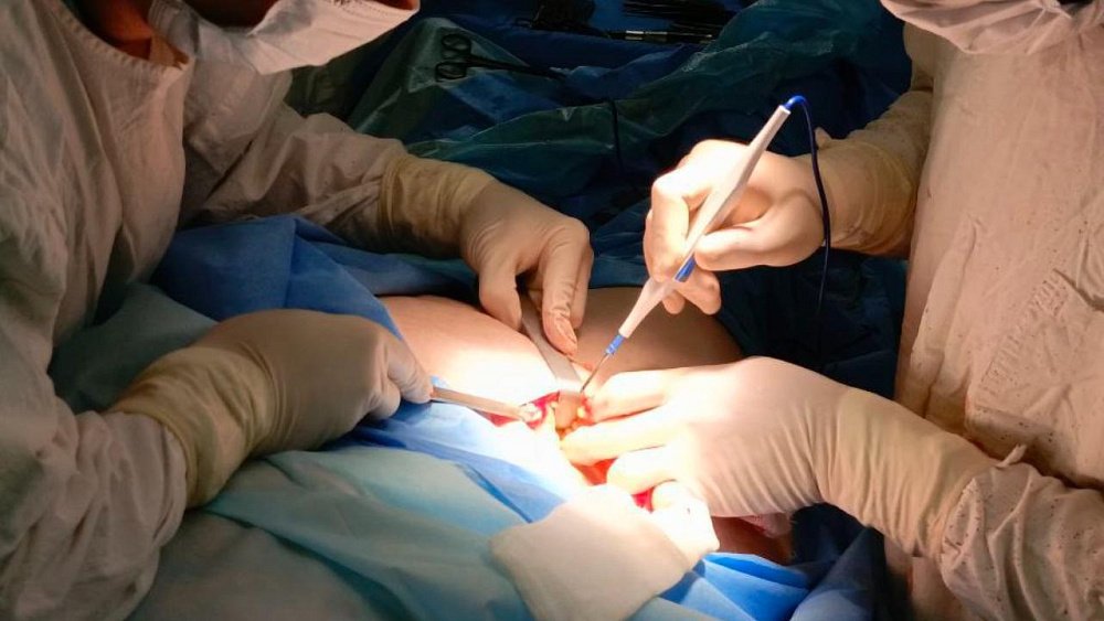 В Челябинском онкоцентре восстановили пораженную кость с помощью ткани пациента