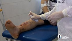 Непогода удвоила количество пациентов в травматологии ЧОКБ